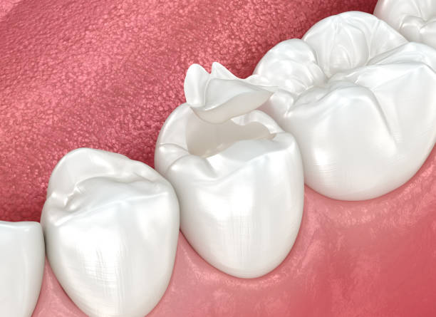 Best Cosmetic Dentistry  in Lake Lorelei, OH